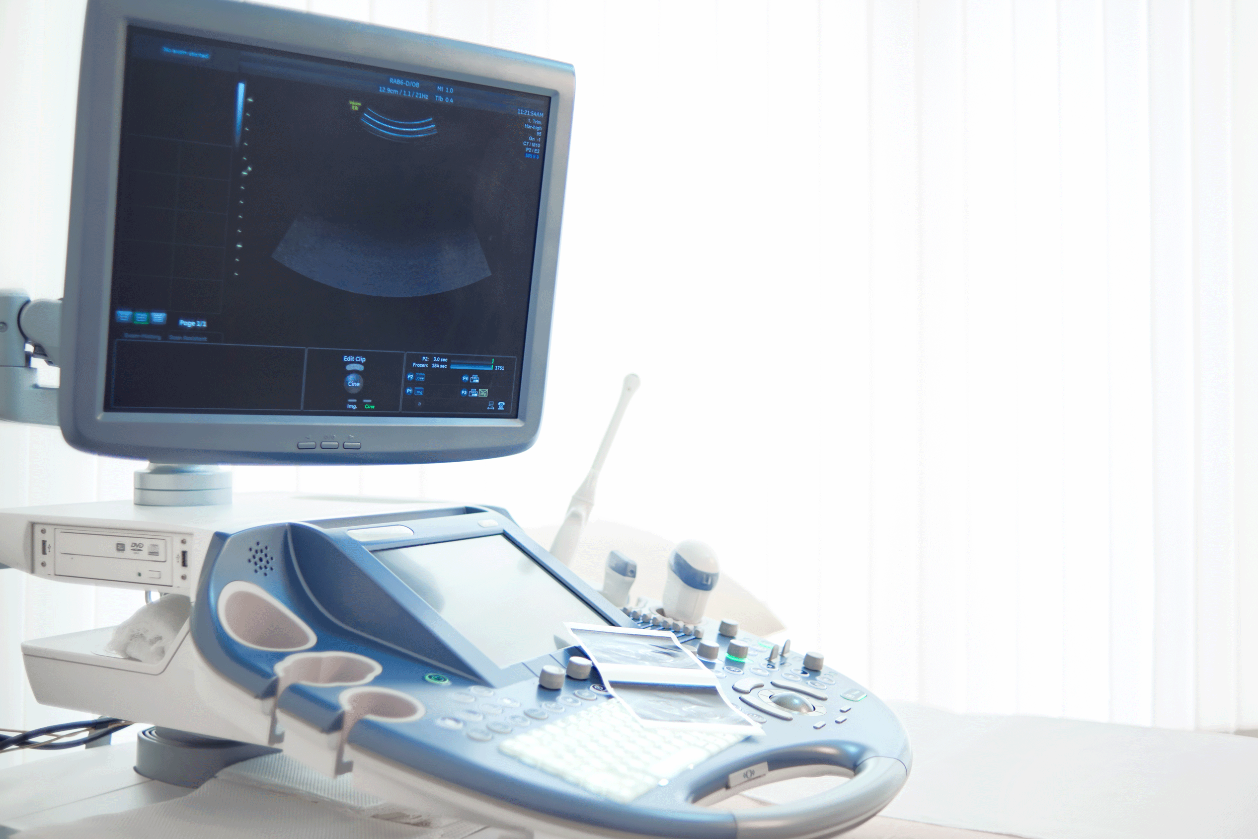 ultrasound-scanning-machine